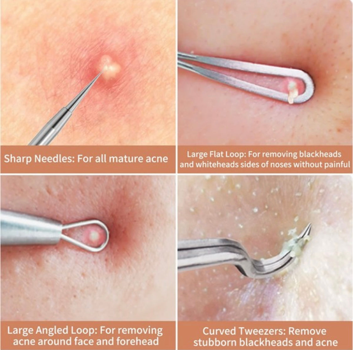 Blackhead Remover Tool Set