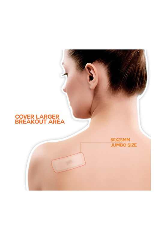 Epielle Acne Clear XL Patch